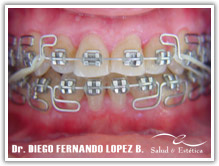 tecnicas-mea.jpg tecnicas-mea.jpg