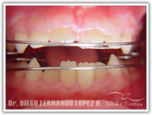 tecnicas-ortopedia-maxilar.jpg tecnicas-ortopedia-maxilar.jpg