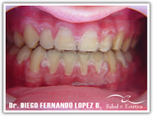 tecnicas-raintree.jpg tecnicas-raintree.jpg